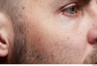  HD Face Skin Raul Conley cheek face skin pores skin texture 0001.jpg